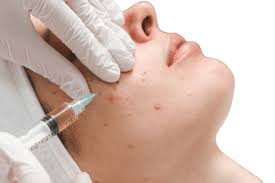 Treatment Image