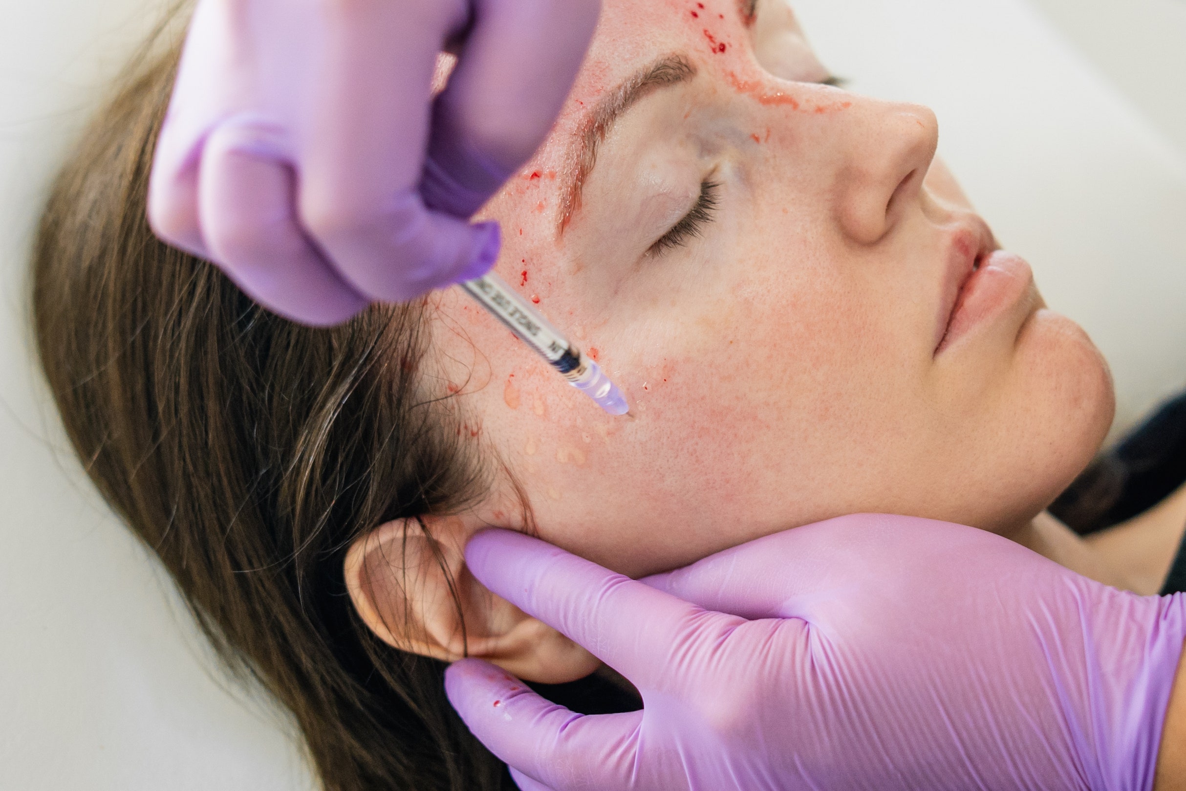 Treatment Image