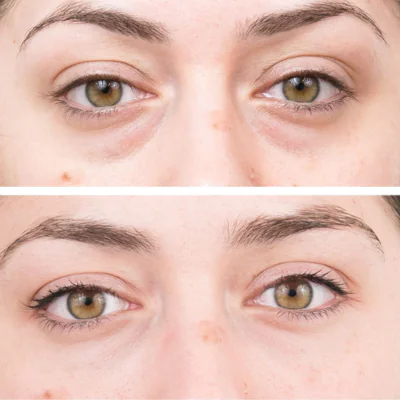 Treatment Image