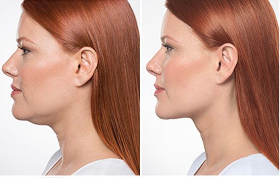 Treatment Image