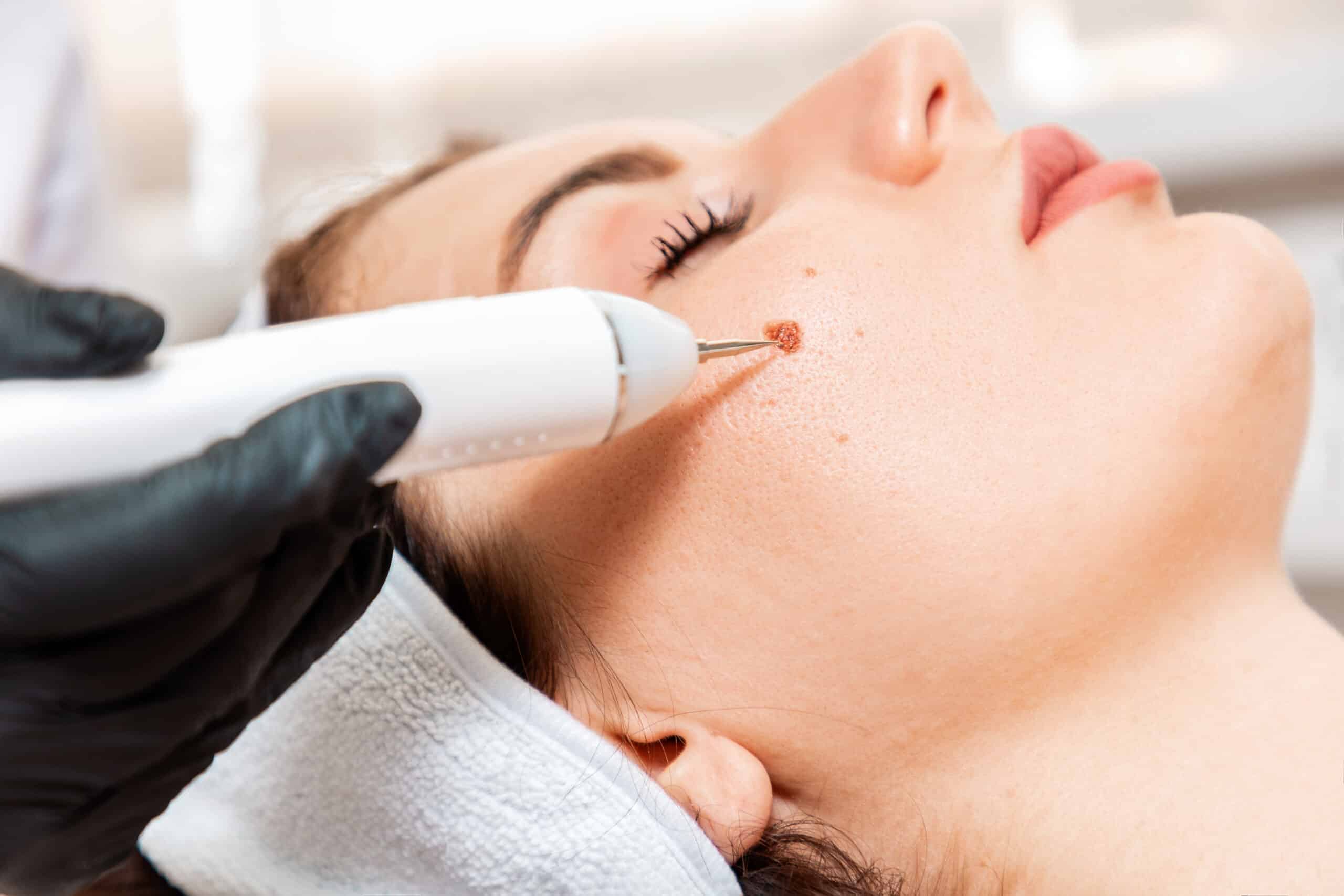 Treatment Image
