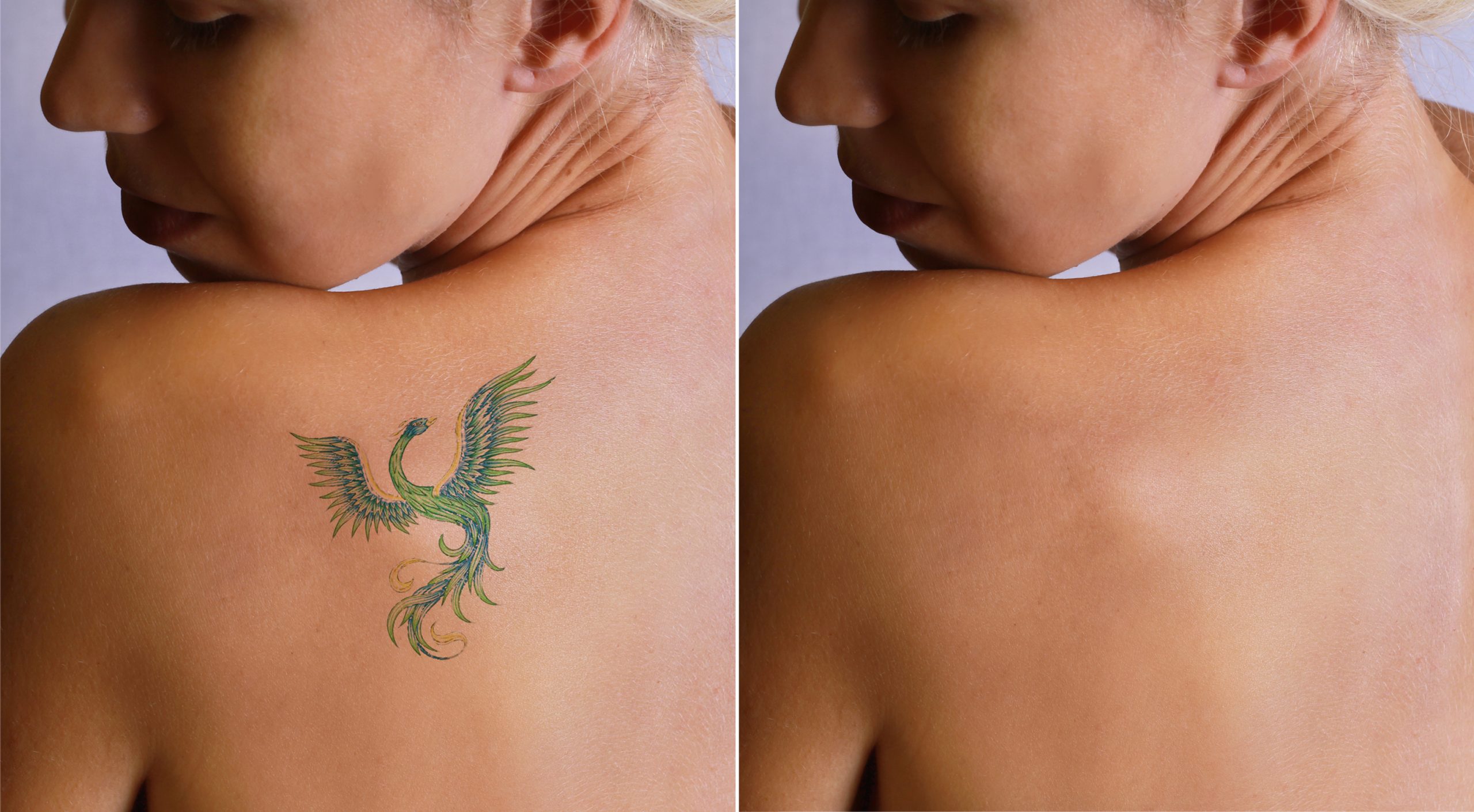 Treatment Image
