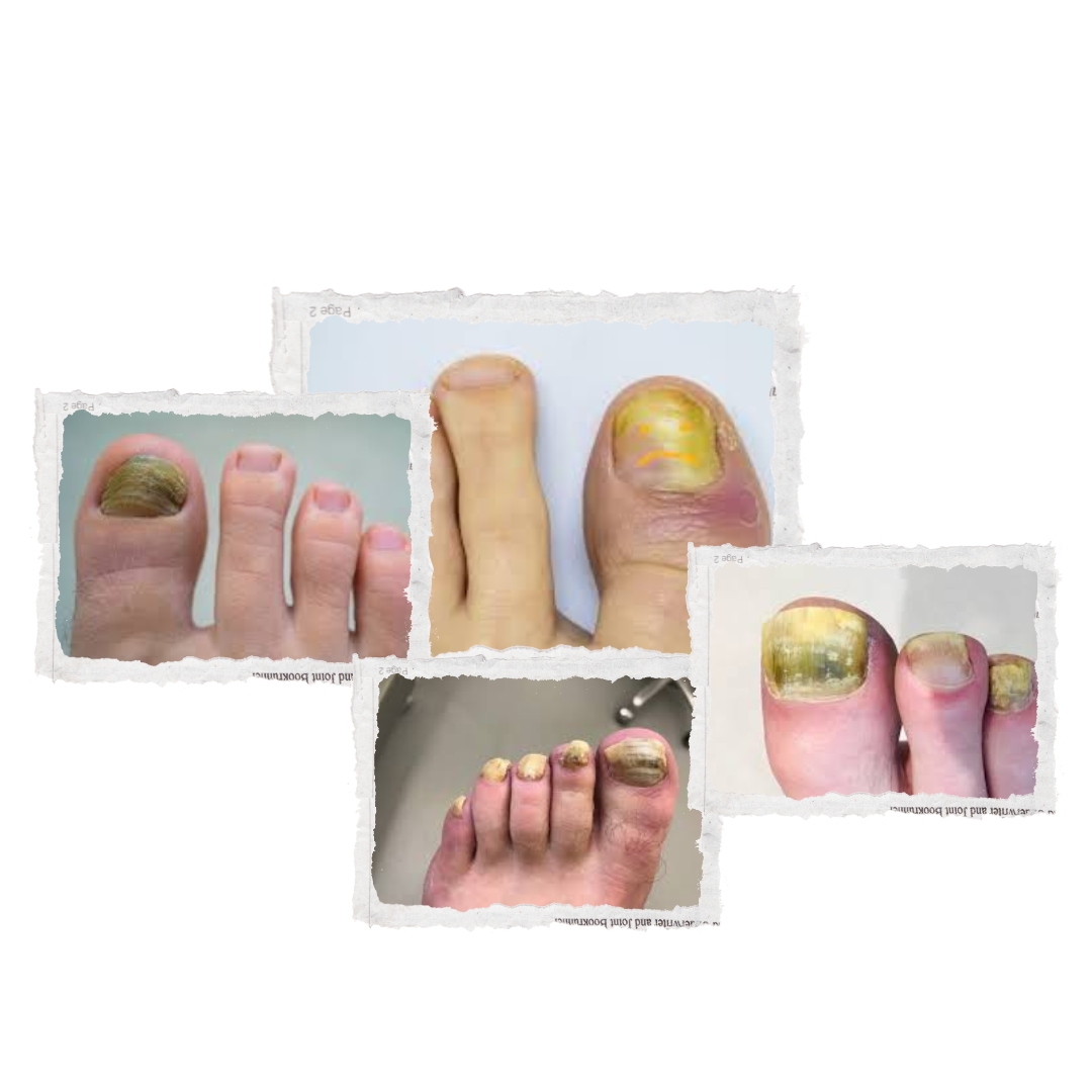 Treatment Image
